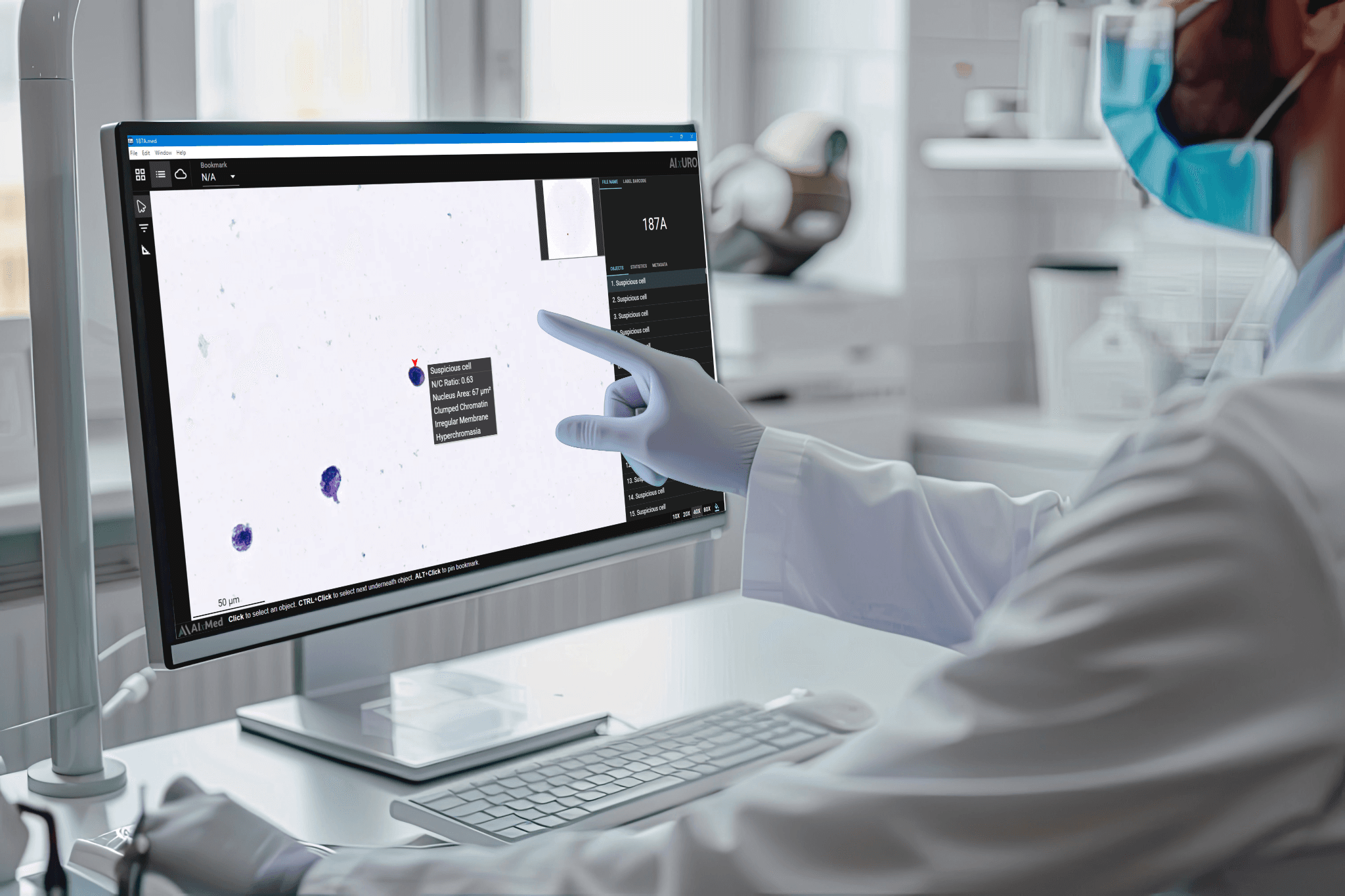 AI-powered cytology analysis on screen