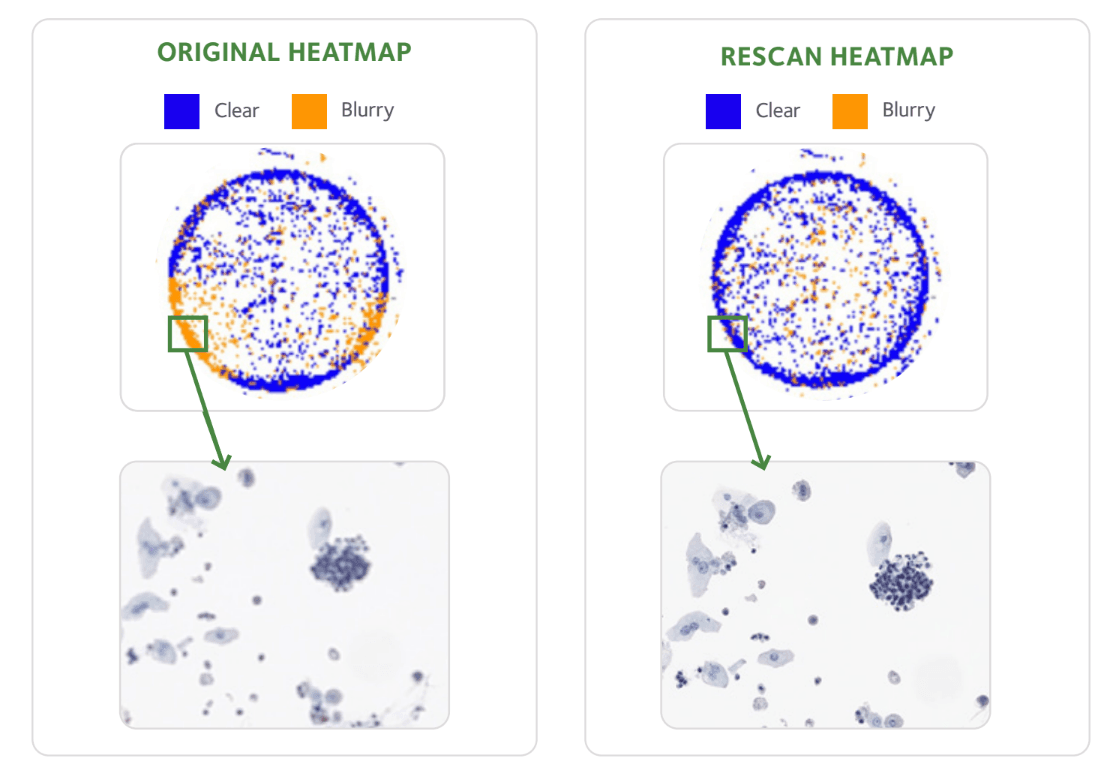 Original and rescan heatmap comparison for ScanPilot quality analysis