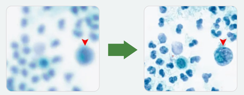 Urine cytology slide before and after ScanPilot focus correction