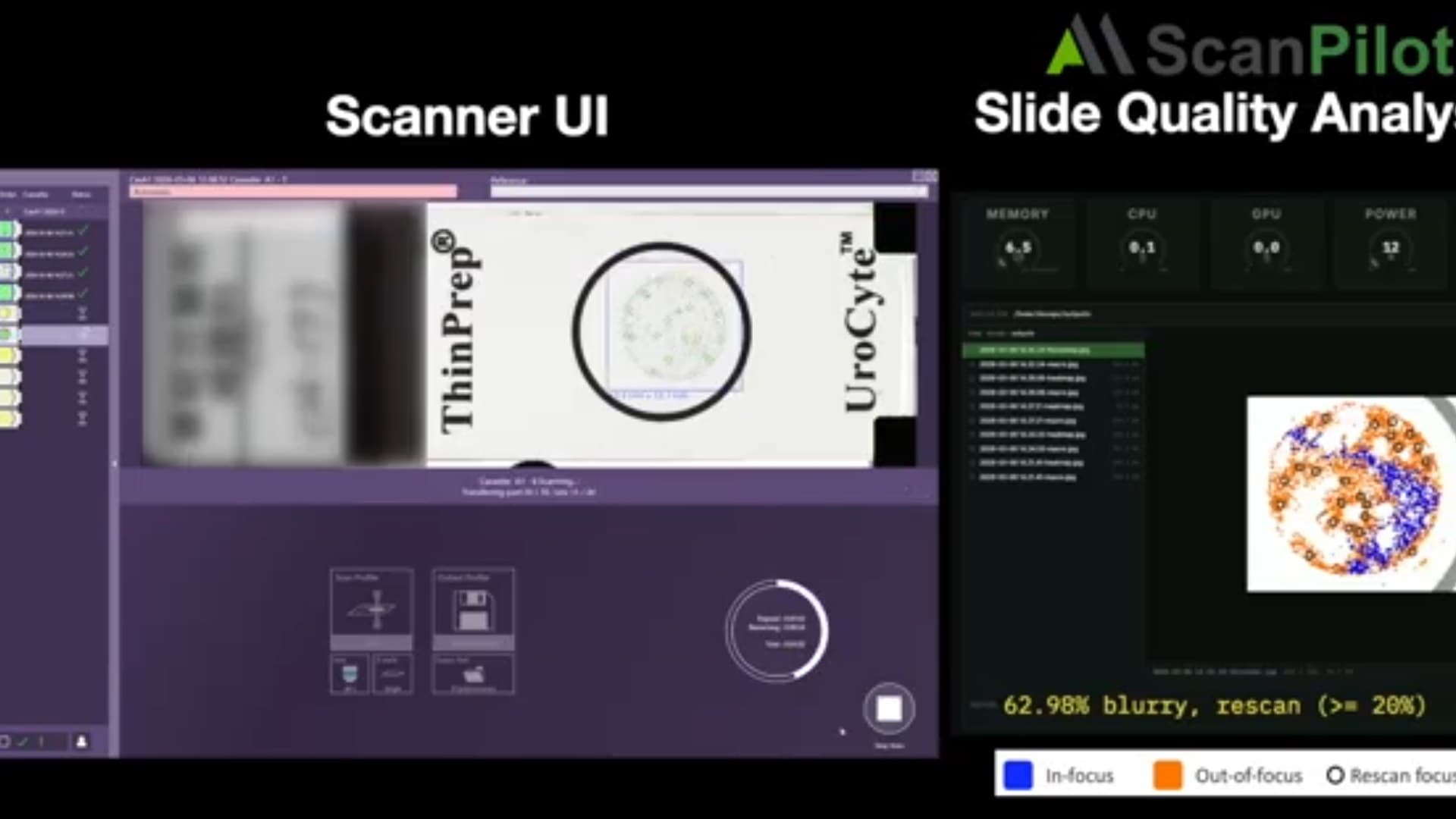 AIxMed ScanPilot autonomous cytology quality analysis demo
