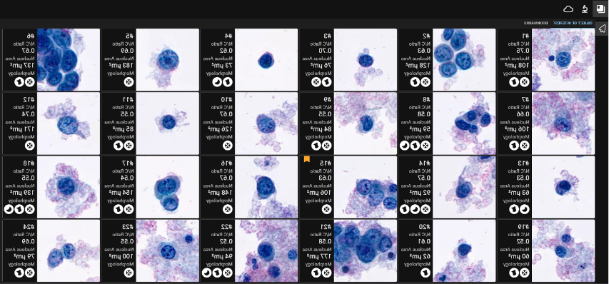 AIxURO ranked cell gallery presentation